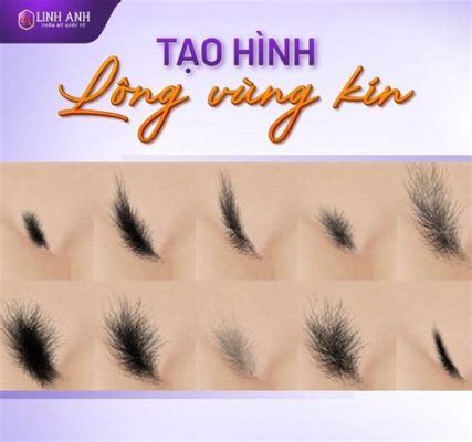  Nhân Ngựa - Con Vật Chân Lông Có Lưỡi Dài Mỏng Như Kim Và Khả Năng Nhảy Cao Tới 3 Mét